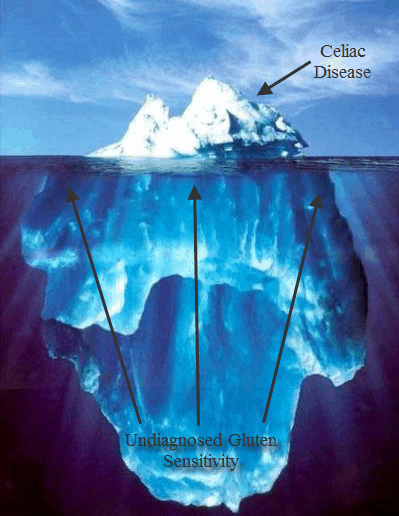 Celiac gluten sensitive iceberg